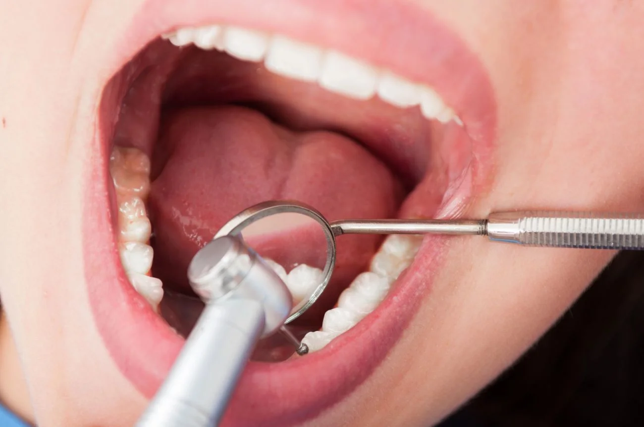 Endodoncja – ratunek dla zębów zagrożonych usunięciem